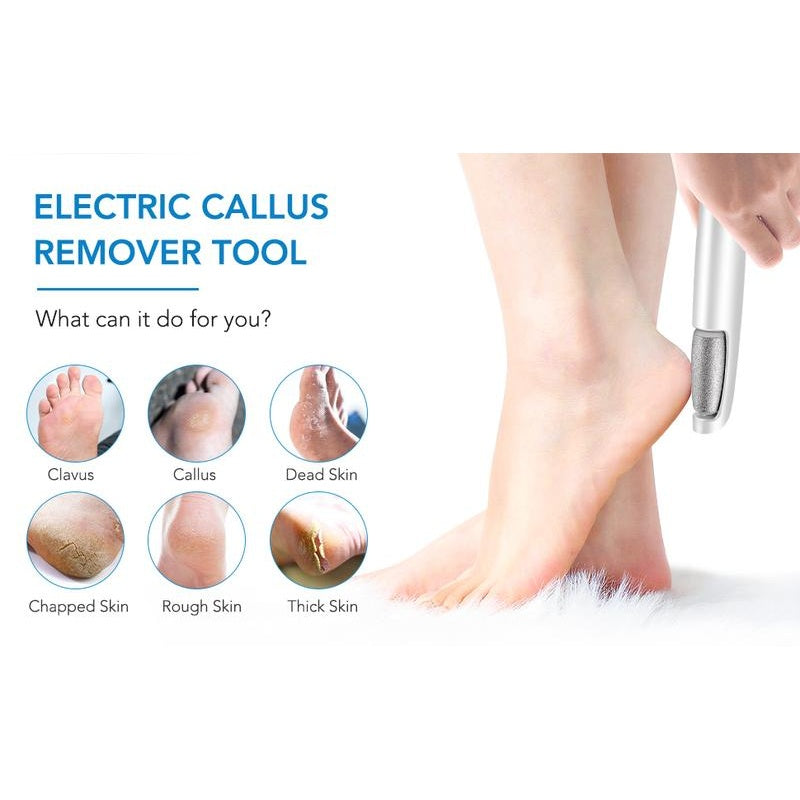 Electric Foot Callus Remover